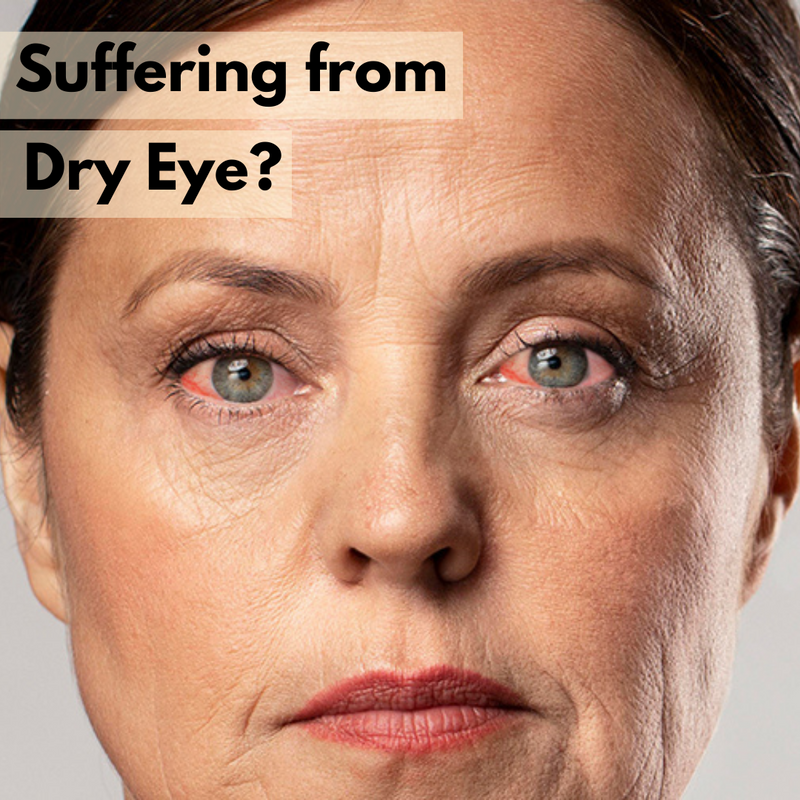 Dry Eye: Cause, Symptoms & Supplements