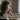 What is Age-Related Macular Degeneration?